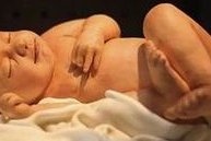 染色体易位在遵义市妇幼保健院可以做三代试管吗？染色体平衡易位还能生健康的宝宝吗？