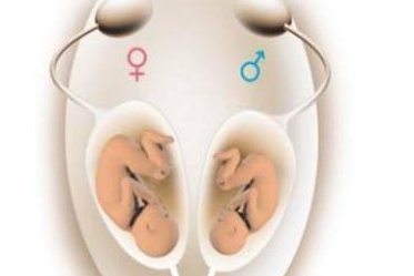 特需出生的孩子是自己的吗 特需试管成功经验分享